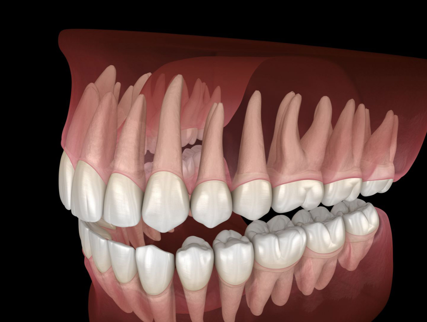 Chirurgie ortognatică