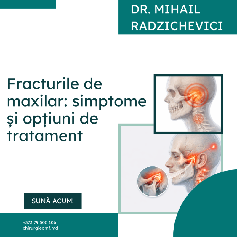 fracturile de maxilar