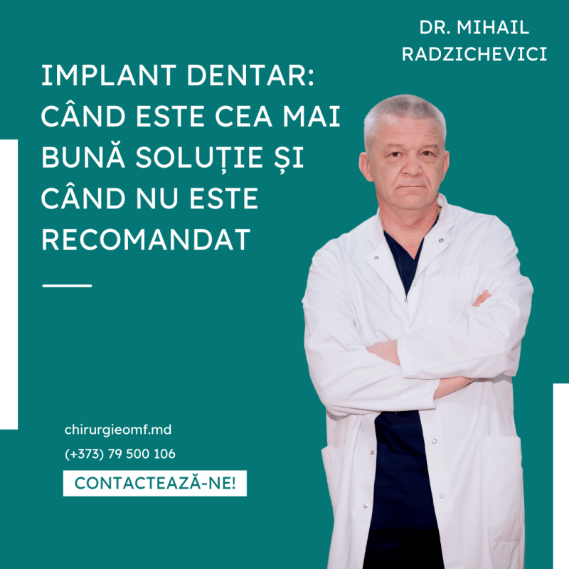 implant dentar