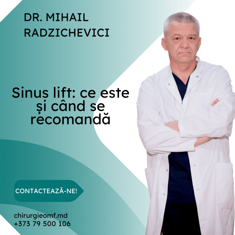 sinus lift