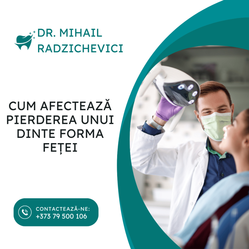 forma feței