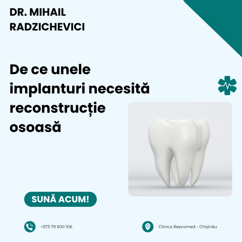 reconstrucție osoasă