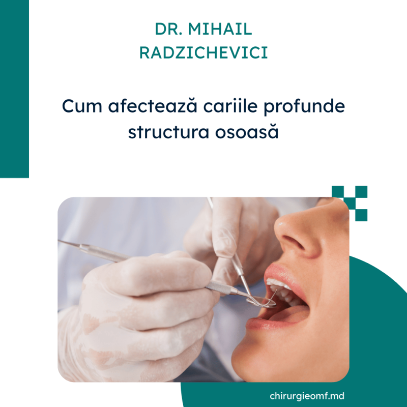 structura osoasă