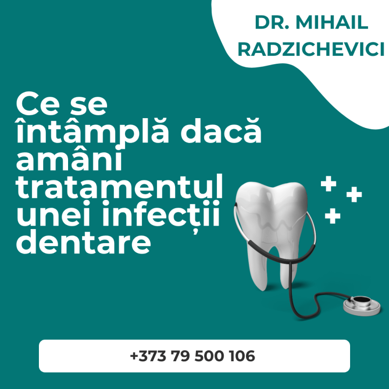 Ce se întâmplă dacă amâni tratamentul unei infecții dentare 1 tratamentul unei infecții dentare