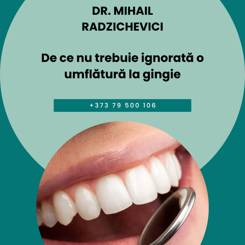 umflătură la gingie